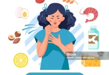 Penting Tahu Penyebab Alergi Makanan