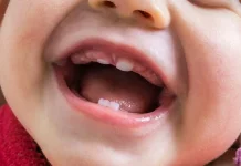 Baby Bottle Tooth Decay, Ancaman Tersembunyi di Balik Kebiasaan Minum Susu dari Bot