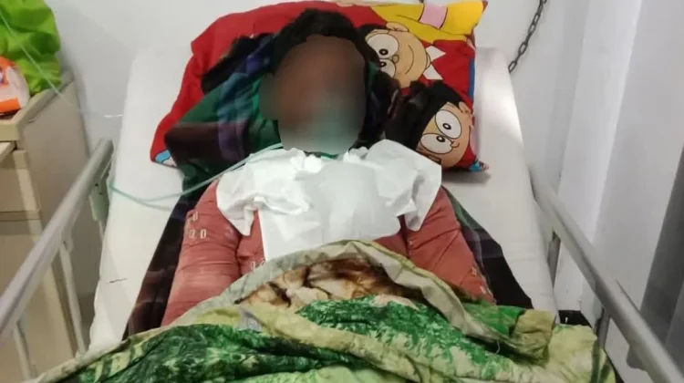 Tragis, Korban Diduga Dibakar Ibu Akhirnya Meninggal