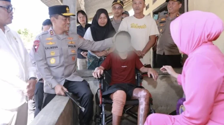 Kasus Santri Terbakar di Lombok Tengah, Berkas Satu Tersangka Sudah P-21