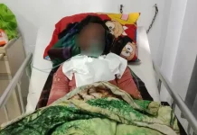 Tragis, Korban Diduga Dibakar Ibu Akhirnya Meninggal