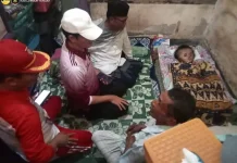 Penderita Hidrosefalus di Lombok Tengah, Dapat Intervensi Terpadu