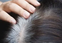 Bahaya Tersembunyi di Balik Kebiasaan Mencabut Uban, Awas Kebotakan Permanen