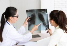 Screening Kanker Paru Dinilai Penting untuk Deteksi Dini