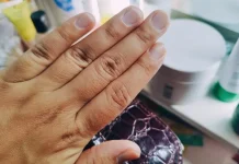 Ketahui Penyebab Kuku Kuning dan Cara Mengatasinya