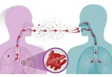 Tuberkulosis, Ketahui Penyebab dan Gejala serta Pencegahannya