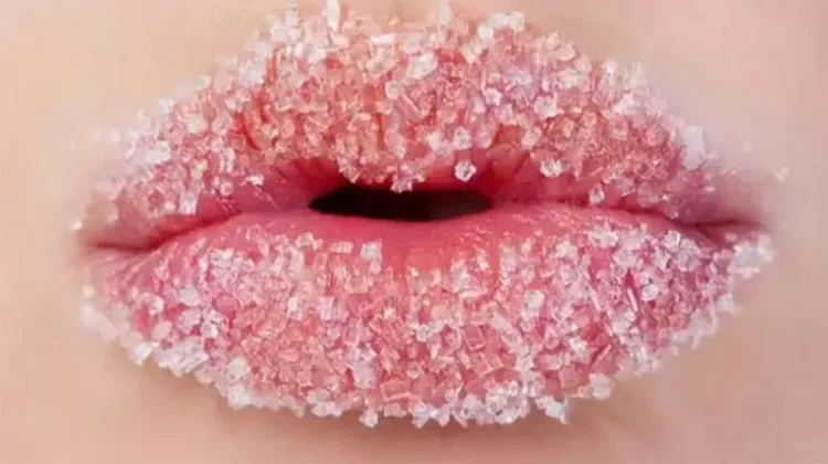 Solusi Ampuh Atasi Bibir Kering saat Puasa
