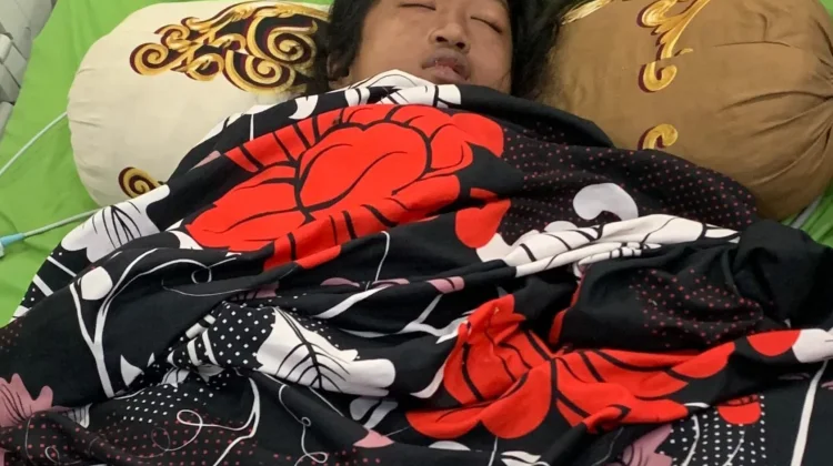 Yulita Remaja Asal Mitem Mengidap Lupus Nefritis Butuh Uluran Tangan Dermawan