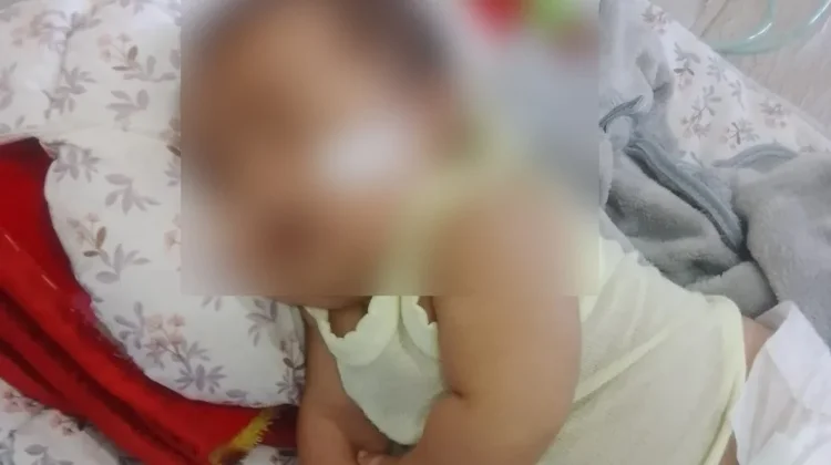 Bayi Bocor Jantung Nagan Raya Harapkan Uluran Tangan