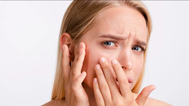 Tips Mengatasi Kulit Kering agar Tetap Sehat dan Lembap