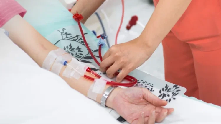 Tips Aman Konsumsi Daging bagi Pasien Cuci Darah