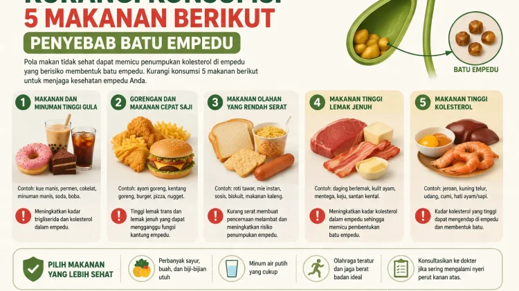 Kurangi Konsumsi 5 Makanan Berikut Penyebab Batu Empedu