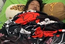 Yulita Remaja Asal Mitem Mengidap Lupus Nefritis Butuh Uluran Tangan Dermawan