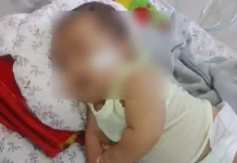 Bayi Bocor Jantung Nagan Raya Harapkan Uluran Tangan