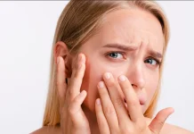 Tips Mengatasi Kulit Kering agar Tetap Sehat dan Lembap
