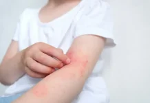 Berikut Beberapa Gejala Autoimun pada Anak yang Patut di Waspadai