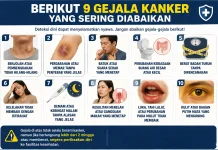 Berikut Gejala Kanker yang Sering Diabaikan