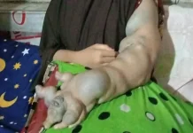 Open Donasi Kemanusiaan, Adik Wartawan Aceh Barat Berjuang Melawan Tumor