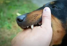 Jangan Panik! Kenali Rabies dan Cara Pertolongan Pertama