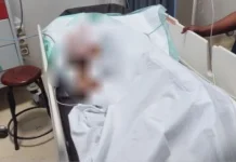 Penganiayaan Terjadi di Kwamki Baru, Korban Dilarikan ke RSUD Mimika