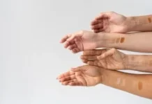 Kenali Undertone Kulit Dengan Cara Ini