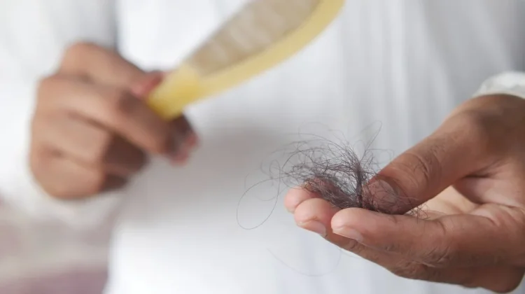 Atasi Rambut Rontok dengan Cara Ini