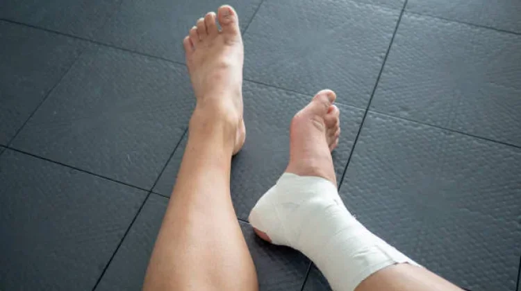 Perbedaan Engkel dan Patah Tulang Kaki