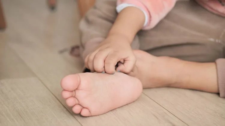 Cegah Kaki Gatal dengan Cara Ini