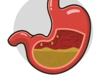 Manfaat Puasa Ramadan untuk Kesehatan Lambung
