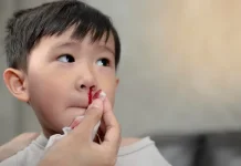 Kanker nasofaring salah satu jenis penyakit yang terjadi pada anak-anak