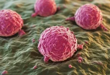 Kenali Gejala dan Pentingnya Deteksi Dini Tumor sel germinal