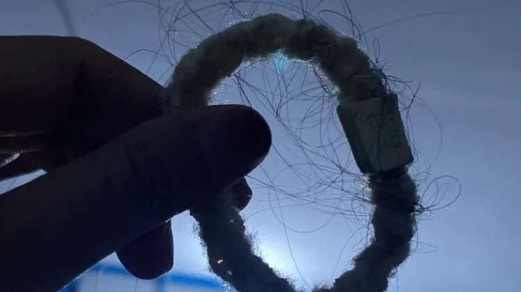 Postpartum Hair Loss: Memahami Kerontokan Rambut pada Ibu Menyusui