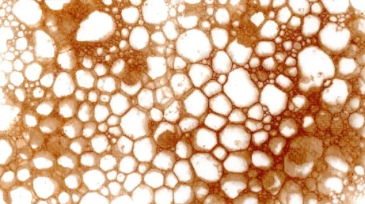 Mengenal Trypophobia Penyebab Gejala dan Cara Mengatasinya Secara Tepat