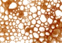Mengenal Trypophobia Penyebab Gejala dan Cara Mengatasinya Secara Tepat
