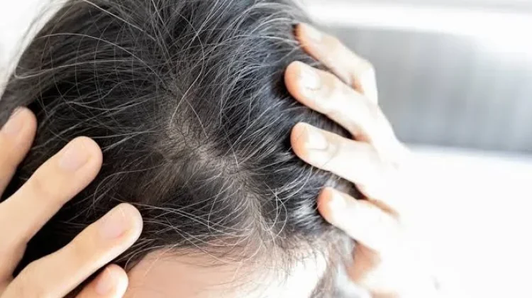 Rambut Putih Dini Tanda Perubahan Tubuh
