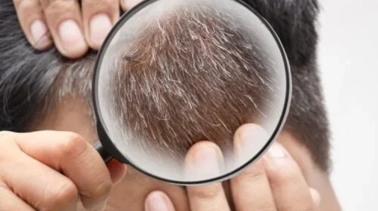Mencabut Uban Dapat Merusak Rambut