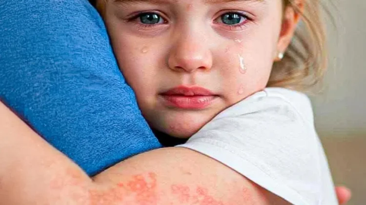 Memilih Antiseptik Aman dan Tidak Pedih untuk Kulit Sensitif Bayi