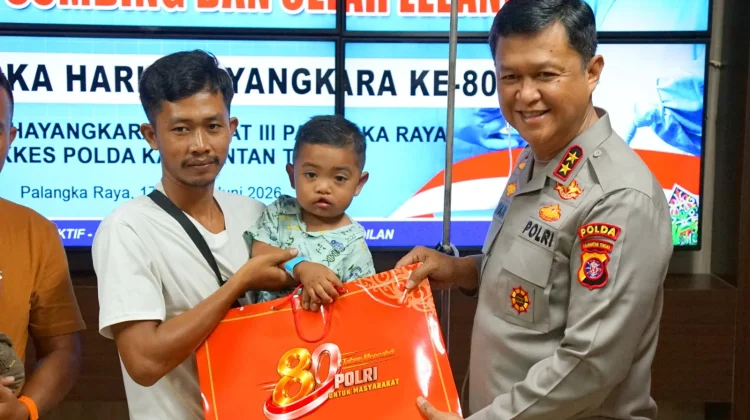 Hari Bhayangkara ke-80, Polda Kalteng Gelar Operasi Bibir Sumbing Gratis