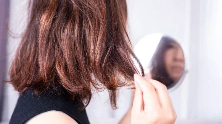 Kondisi Rambut Ini Tunjukkan Masalah Kesehatan Tubuh, Perlu Diketahui