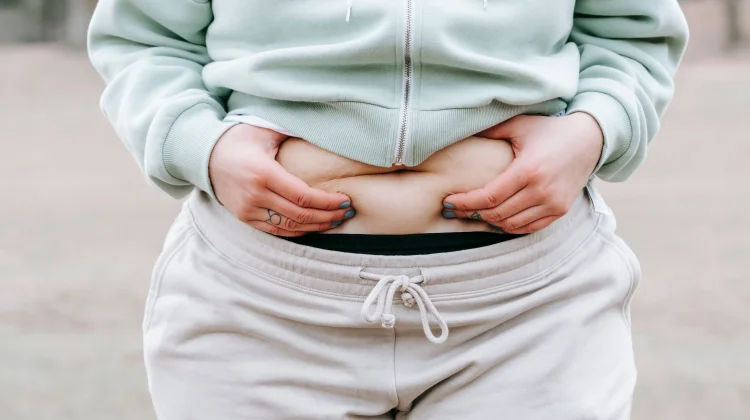 Mengenal Cortisol Belly, Lemak Perut yang Muncul Akibat Stress
