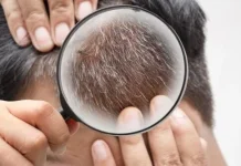 Mencabut Uban Dapat Merusak Rambut