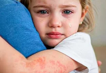 Memilih Antiseptik Aman dan Tidak Pedih untuk Kulit Sensitif Bayi