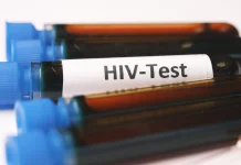 Kasus HIV/AIDS di Palangka Raya Meningkat, Pemicunya Pasien Luar Kota