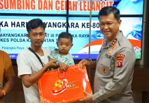 Hari Bhayangkara ke-80, Polda Kalteng Gelar Operasi Bibir Sumbing Gratis