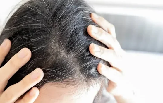 Rambut Putih Dini Tanda Perubahan Tubuh - RRI.co.id