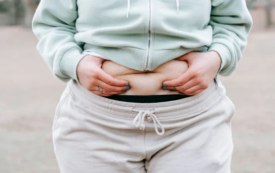 Mengenal Cortisol Belly, Lemak Perut yang Muncul Akibat Stress