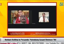 Rontgen Keliling Percepat Eliminasi TBC di Palembang