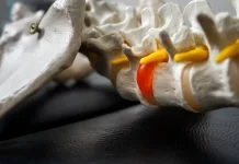 Mengenal Penyakit Paget, Gangguan tulang yang Bisa Muncul tanpa Gejala