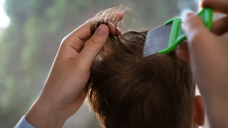 Kebiasaan Sehari-hari yang Bisa Menularkan Kutu Rambut
