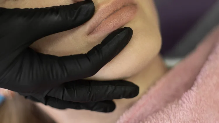 Sulam Bibir Makin Populer, Risikonya bagi Kesehatan